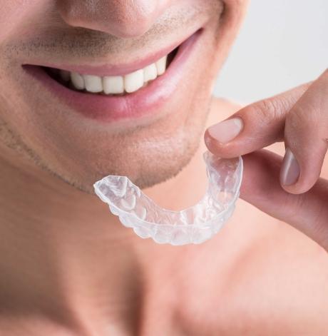 Aligner